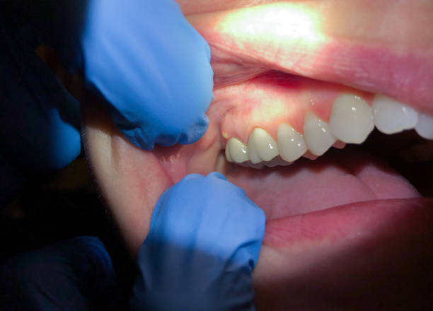 Best Cracked Tooth Emergency Dentist  in North Newton, KS